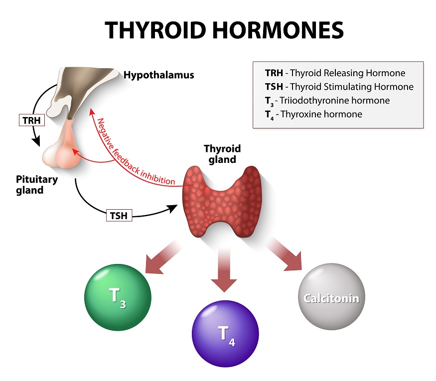 Hypothyroidism: Causes and Management