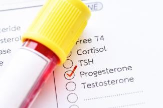 La carence en progestérone - Une épidémie hormonale