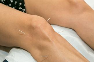 膝の痛みのための鍼治療：症例報告
