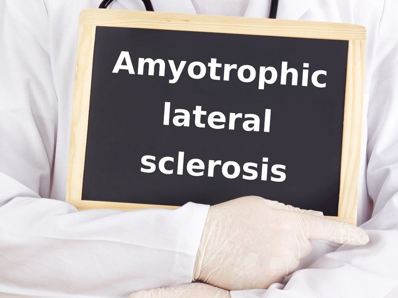 Esclerosis Lateral Amiotrófica 