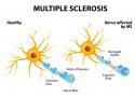 Multiple Sclerosis - Is It Just an Autoimmune Condition?