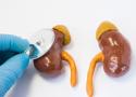 Naturopathic Approaches to Supporting the Kidneys