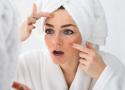 The Naturopathic Pillars of Treating Adult Acne 
