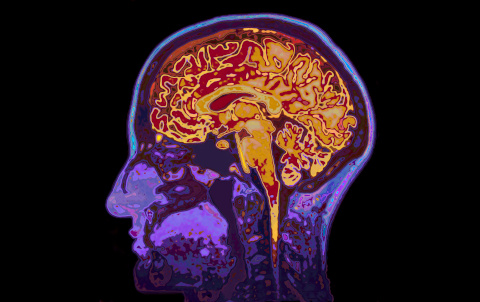 brain