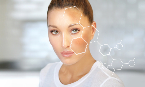 Hyperpigmentation