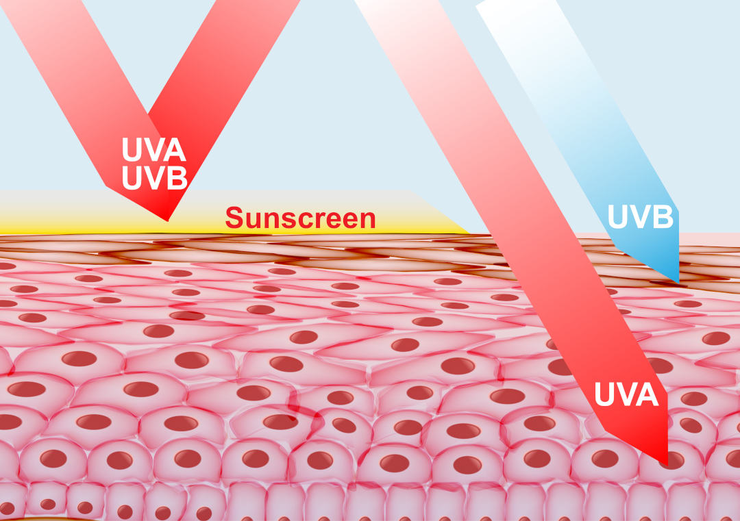 uv