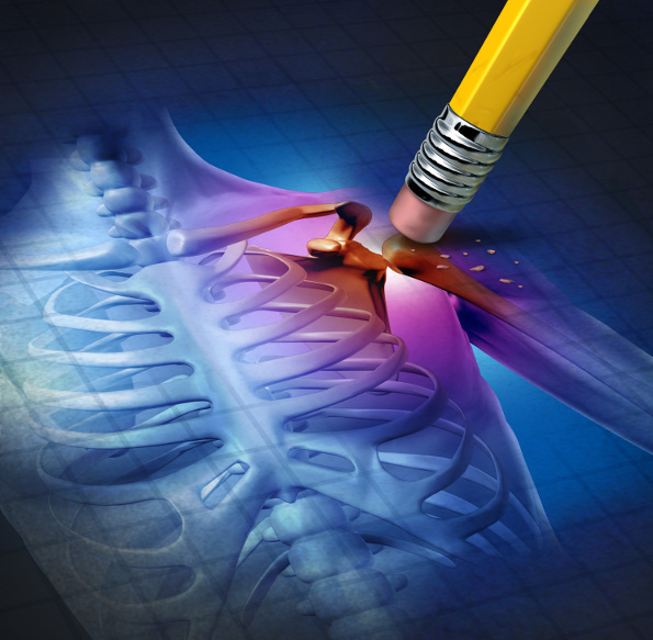 Prolothérapie et traitement PRP - Trois raisons de leur supériorité sur les injections de cortisone