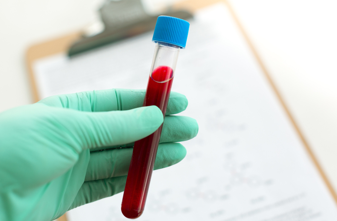 The Development of Food Sensitivities - True and False Sensitivities and What to Do About Them
