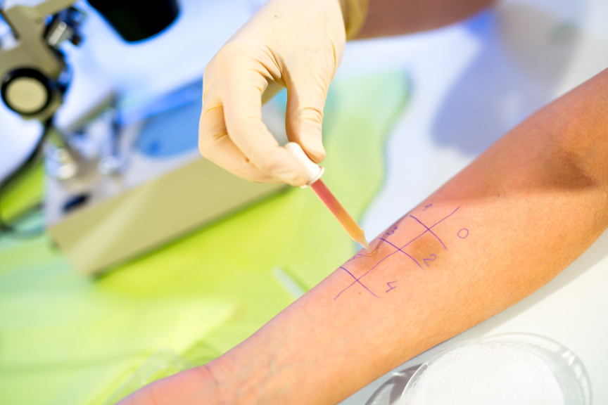What Does It Mean to Be Adrenal-Fatigued? - Naturopathic Assessments and Supports
