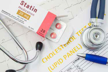 Statin Side Effects